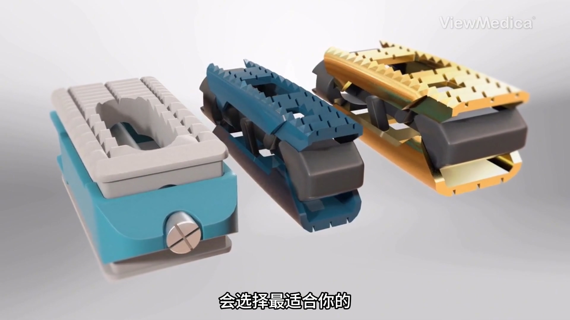 用可伸缩笼进行椎体间融合-医疗...