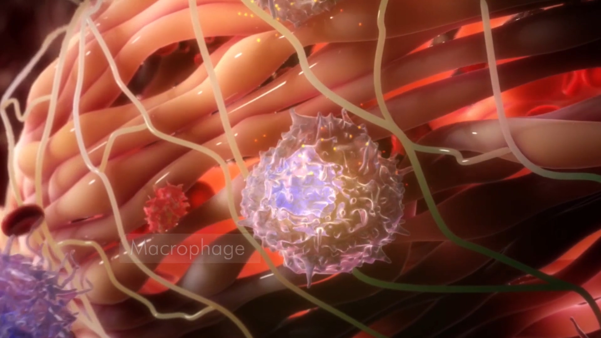 医疗输血疗法脾\胆囊切除术医学演绎动画