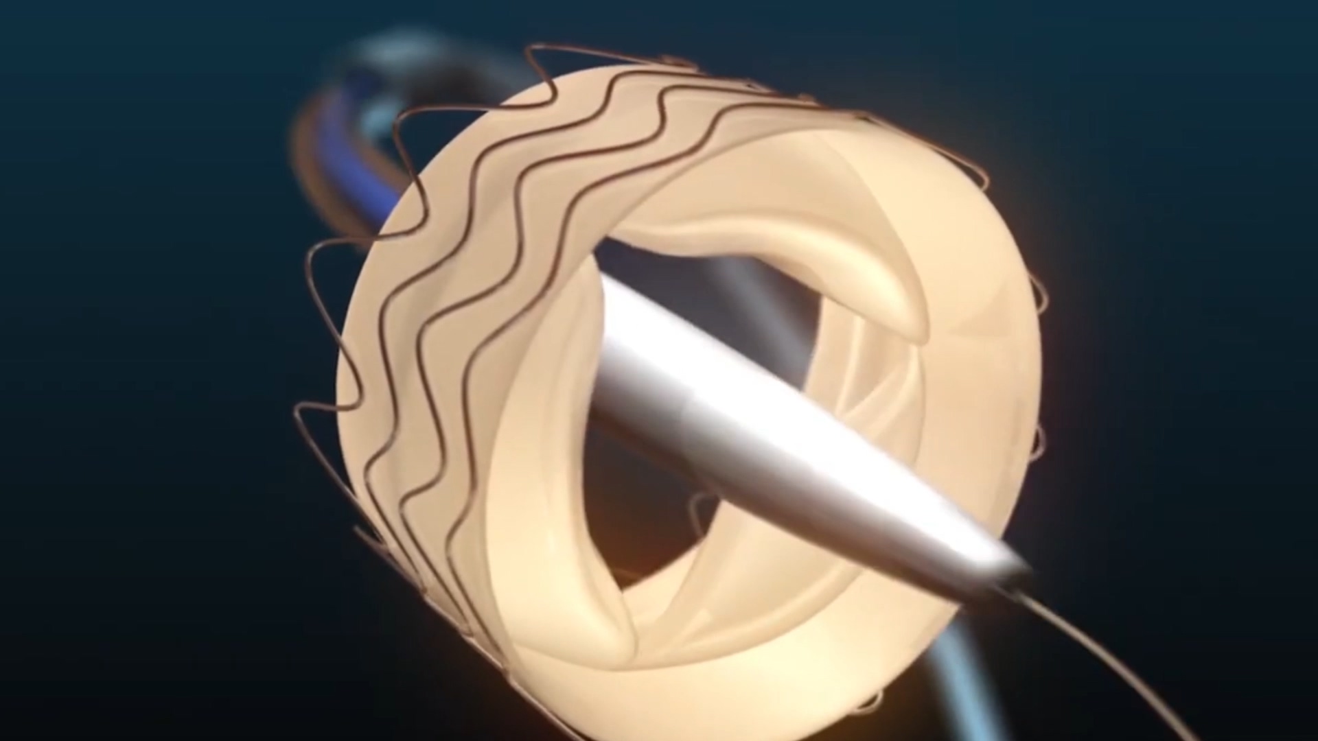 医疗器械产品三维动画