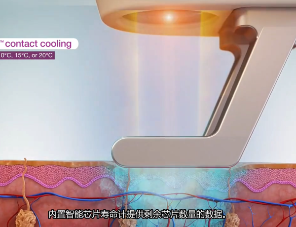 美容激光器-医学原理动画