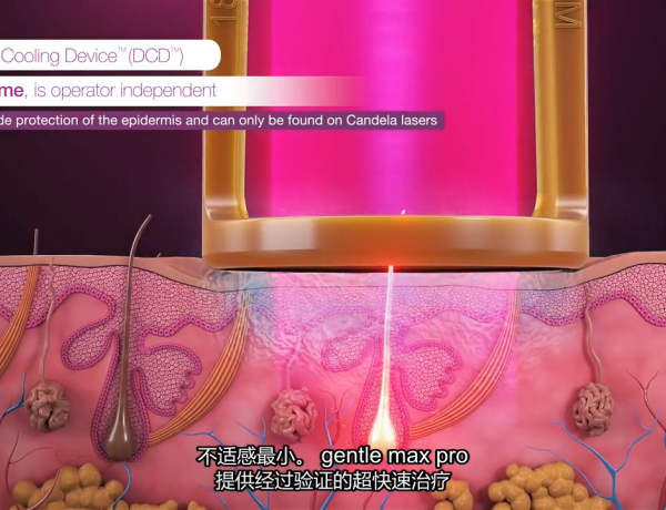 医美激光器-医学原理动画视频制作