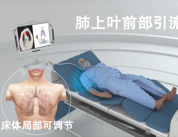 医学动画肺下叶后补引流手术过程动画
